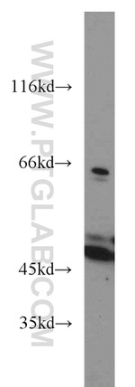 ACADM Antibody in Western Blot (WB)
