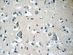 ARHGEF4 Antibody in Immunohistochemistry (Paraffin) (IHC (P))