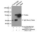 ARHGEF4 Antibody in Immunoprecipitation (IP)
