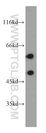 GDI1 Antibody in Western Blot (WB)