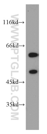 GDI1 Antibody in Western Blot (WB)