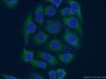 EPHA5 Antibody in Immunocytochemistry (ICC/IF)