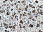 EPHA5 Antibody in Immunohistochemistry (Paraffin) (IHC (P))