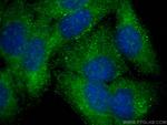 CYP8B1 Antibody in Immunocytochemistry (ICC/IF)