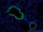 SPTA1 Antibody in Immunohistochemistry (PFA fixed) (IHC (PFA))