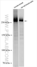 SPTA1 Antibody in Western Blot (WB)