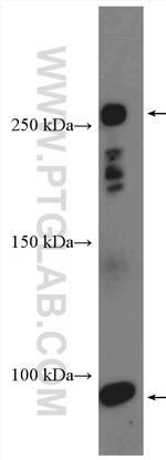 C4-B alpha chain/C4b-B/C4d-B Antibody in Western Blot (WB)