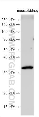 UPK3A Antibody in Western Blot (WB)