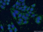 ENO3 Antibody in Immunocytochemistry (ICC/IF)