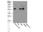 ENO3 Antibody in Western Blot (WB)