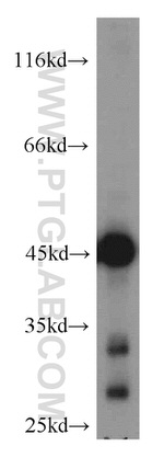 ENO3 Antibody in Western Blot (WB)