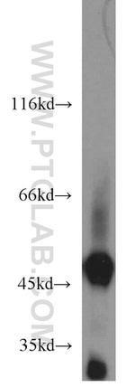 ENO3 Antibody in Western Blot (WB)