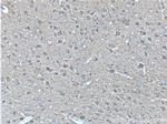 NSE/ENO2 Antibody in Immunohistochemistry (Paraffin) (IHC (P))