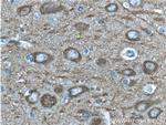 NSE/ENO2 Antibody in Immunohistochemistry (Paraffin) (IHC (P))
