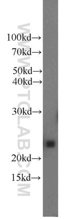 Placental lactogen Antibody in Western Blot (WB)