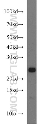 Placental lactogen Antibody in Western Blot (WB)