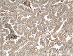 TPSD1 Antibody in Immunohistochemistry (Paraffin) (IHC (P))