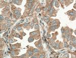 TPSD1 Antibody in Immunohistochemistry (Paraffin) (IHC (P))