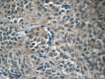 GH2 Antibody in Immunohistochemistry (Paraffin) (IHC (P))