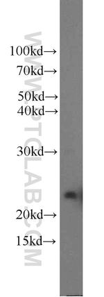 GH2 Antibody in Western Blot (WB)