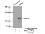 HCN2 Antibody in Immunoprecipitation (IP)