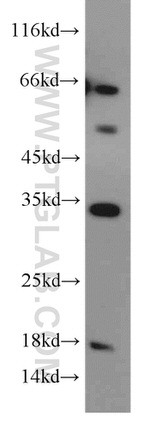 GPR35 Antibody in Western Blot (WB)