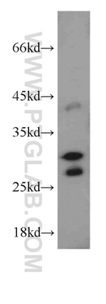 GPR35 Antibody in Western Blot (WB)