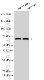 MASP2 Antibody in Western Blot (WB)