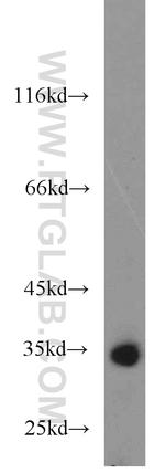 RCBTB1 Antibody in Western Blot (WB)