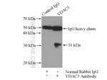 VDAC3 Antibody in Immunoprecipitation (IP)