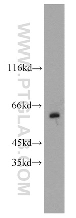 MAOB Antibody in Western Blot (WB)