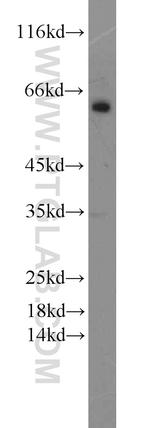 MAOB Antibody in Western Blot (WB)