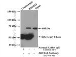 ZBTB33 Antibody in Immunoprecipitation (IP)