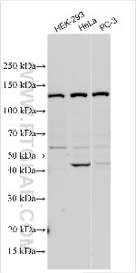 DRAM Antibody in Western Blot (WB)