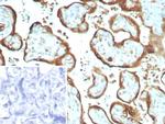 IMP-3 Recombinant Rabbit Monoclonal Antibody (IMP3/8934R)