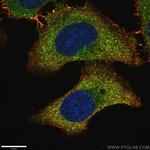 LAMP1 Antibody in Immunocytochemistry (ICC/IF)