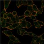 PHF10 (Transcription Factor) Monoclonal Antibody (PCRP-PHF10-2A10)