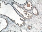 CTAGE5 Antibody in Immunohistochemistry (Paraffin) (IHC (P))
