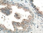 CTAGE5 Antibody in Immunohistochemistry (Paraffin) (IHC (P))