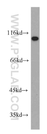 CTAGE5 Antibody in Western Blot (WB)