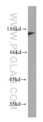 CTAGE5 Antibody in Western Blot (WB)