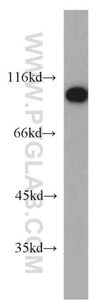 CTAGE5 Antibody in Western Blot (WB)