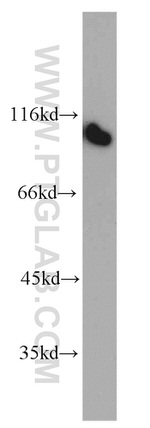 CTAGE5 Antibody in Western Blot (WB)