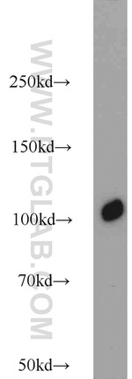 CTAGE5 Antibody in Western Blot (WB)