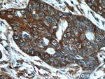 MMP21 Antibody in Immunohistochemistry (Paraffin) (IHC (P))
