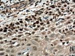 FBXW7 Antibody in Immunohistochemistry (Paraffin) (IHC (P))