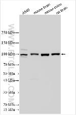 RANK/TNFRSF11A Antibody in Western Blot (WB)
