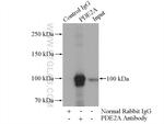 PDE2A Antibody in Immunoprecipitation (IP)