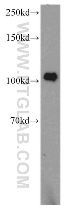 PDE2A Antibody in Western Blot (WB)