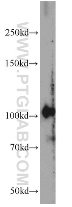 PDE2A Antibody in Western Blot (WB)